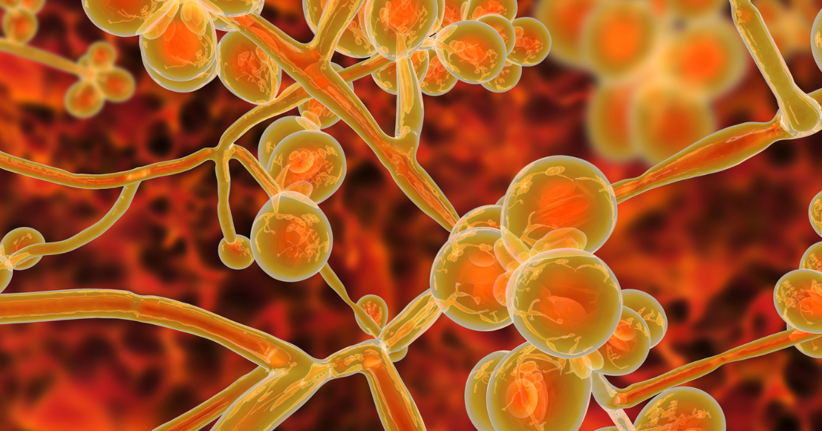 Candida auris fungal infection What is it and who is at risk